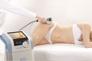 Exilis - prbh aplikace exilis